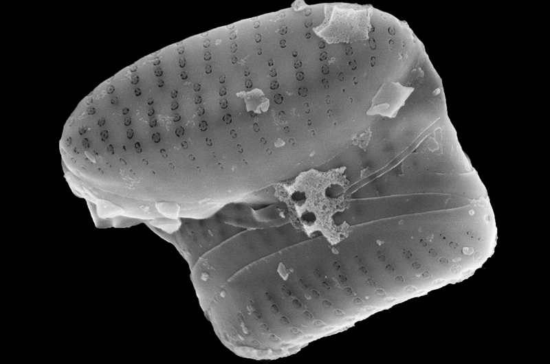 A microscopic image of Fragilaria amicorum.
